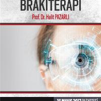GözTümörlerindeBrakiterapi